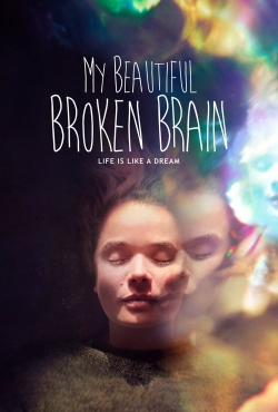 My Beautiful Broken Brain free movies