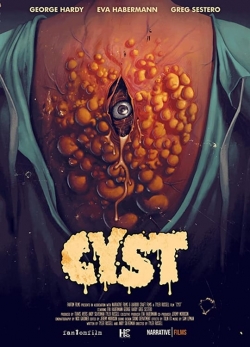 Cyst free movies